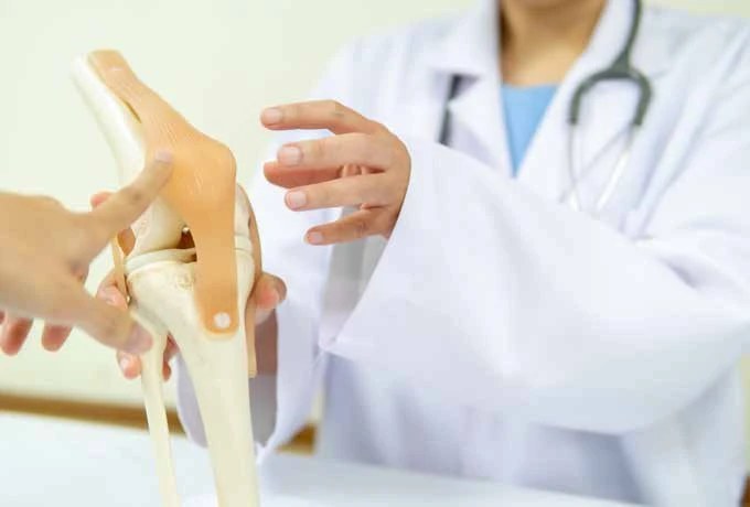 Doctor discussing a knee model