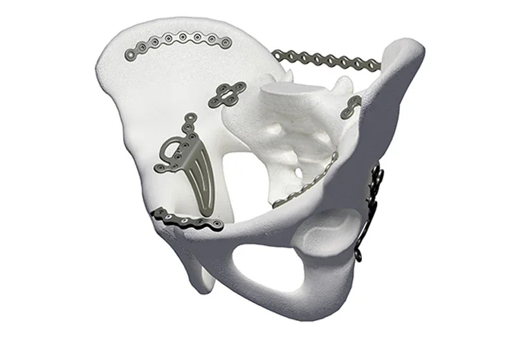 Orthopedic Plates — Product 0002 — Orthopedic Plates