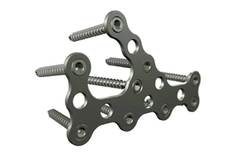 Orthopedic Plates — Product 0017 — Orthopedic Plates