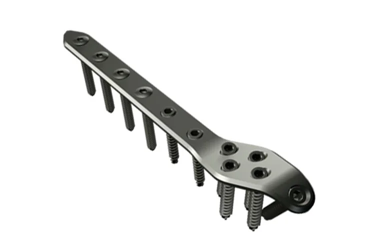 Orthopedic Plates — Product 0033 — Orthopedic Plates