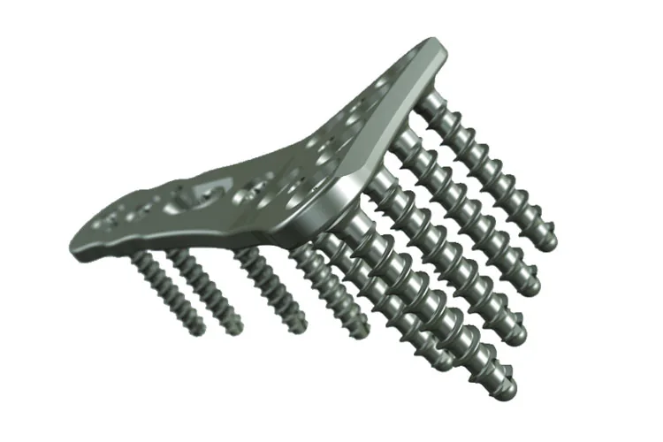 Orthopedic Plates — Product 0034 — Orthopedic Plates