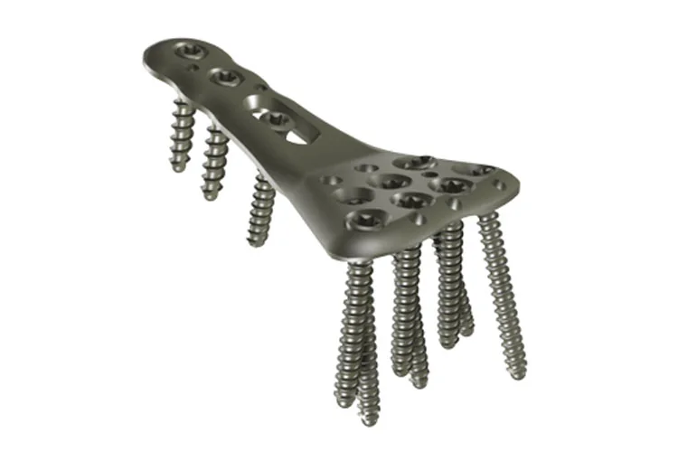 Orthopedic Plates — Product 0035 — Orthopedic Plates