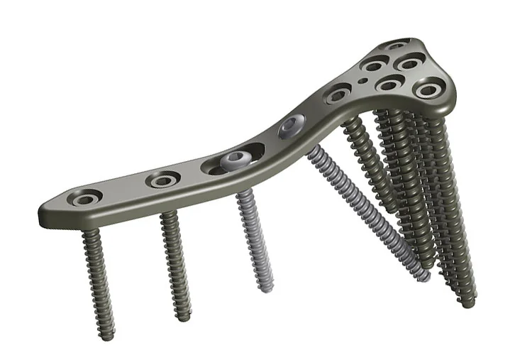 Orthopedic Plates — Product 0036 — Orthopedic Plates