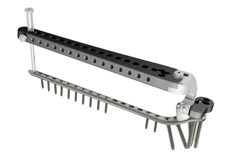 Orthopedic Plates — Product 0038 — Orthopedic Plates