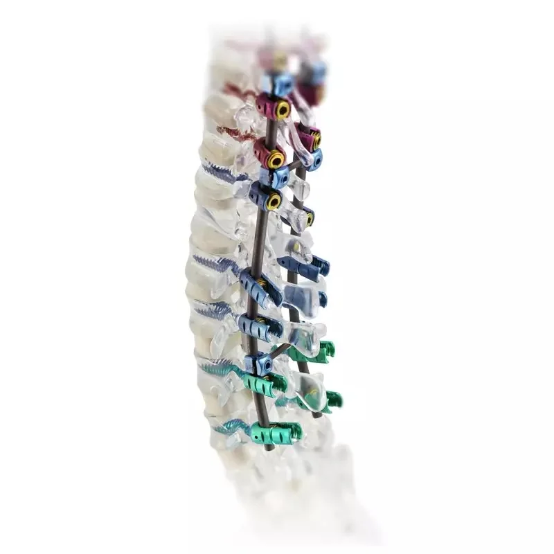 Spinal Instruments — Product 0056 — Spinal Instruments