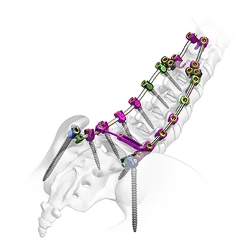 Spinal Instruments — Product 0057 — Spinal Instruments