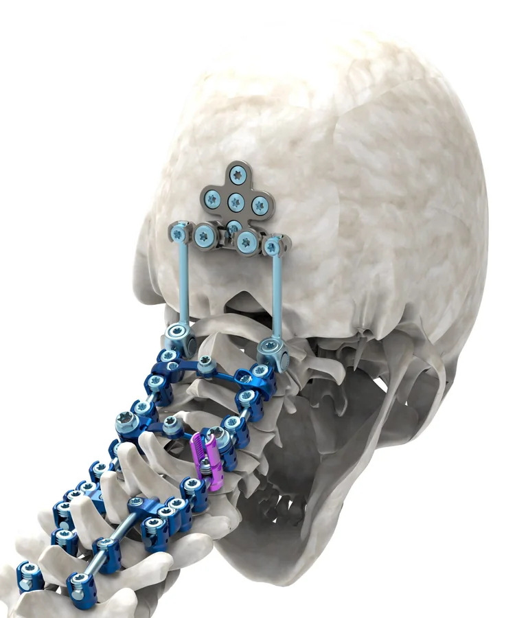 Spinal Instruments — Product 0059 — Spinal Instruments