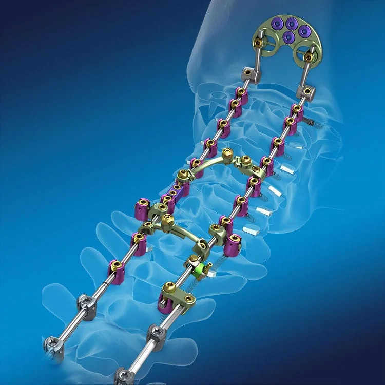 Spinal Instruments — Product 0061 — Spinal Instruments