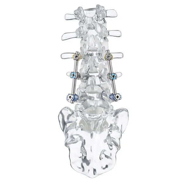Spinal Instruments — Product 0072 — Spinal Instruments