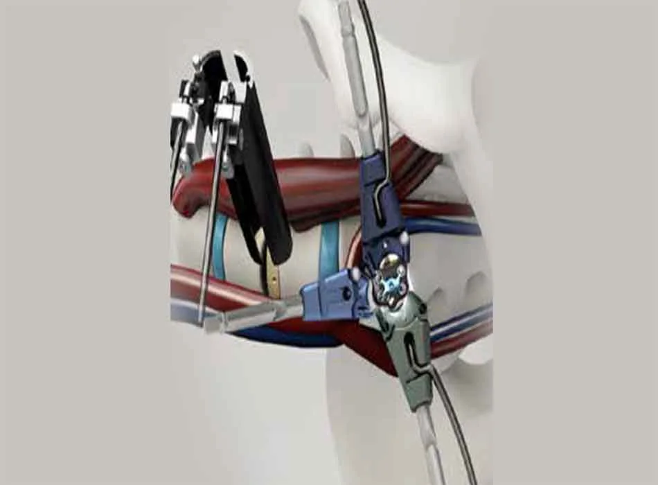 Cervical Instruments — Product 0103 — Cervical Instruments