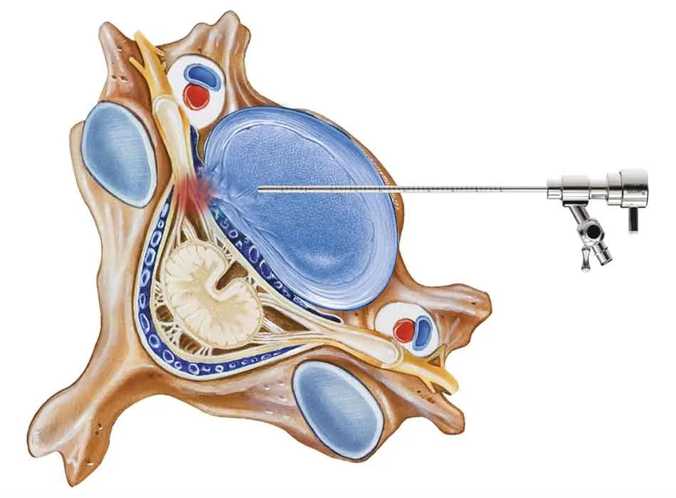 Cervical Instruments — Product 0105 — Cervical Instruments