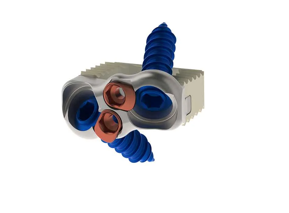 Cervical Instruments — Product 0120 — Cervical Instruments