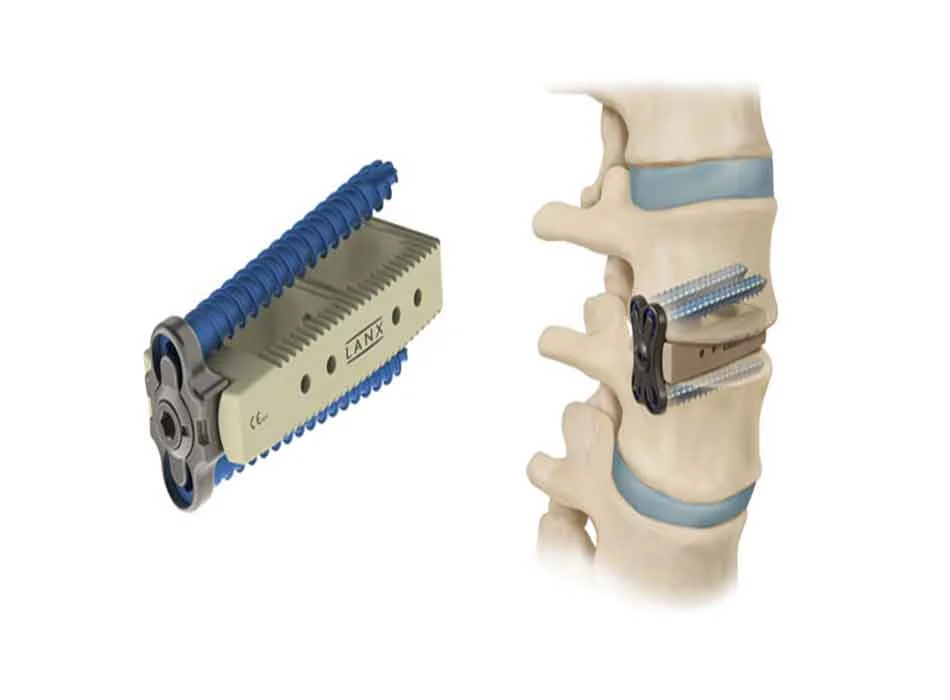 Cervical Instruments — Product 0126 — Cervical Instruments