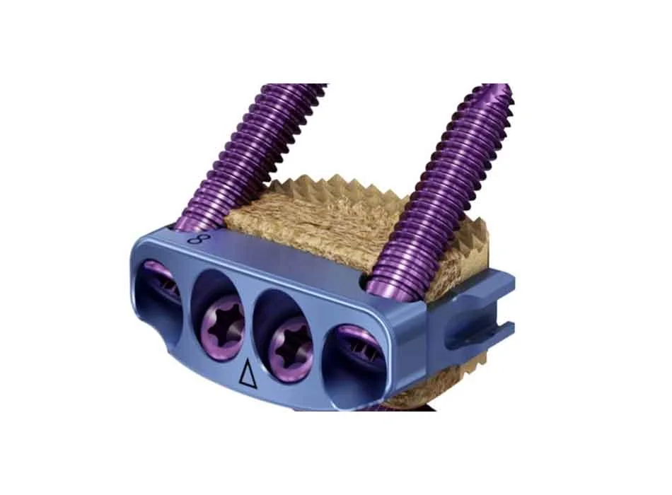 Cervical Instruments — Product 0127 — Cervical Instruments