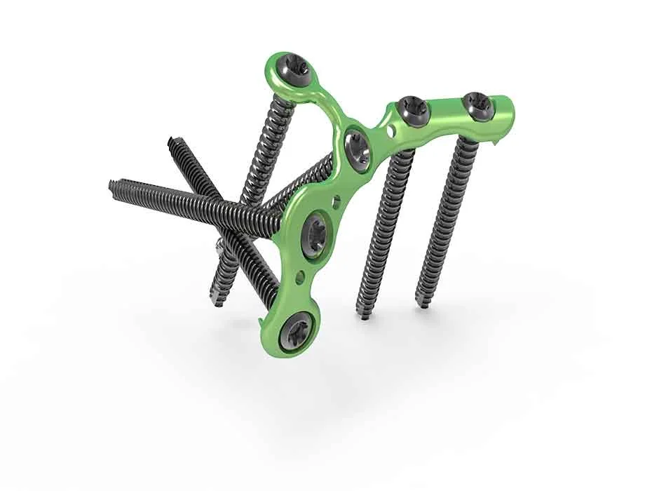 Orthopedic Instruments — Product 0304 — Orthopedic Instruments
