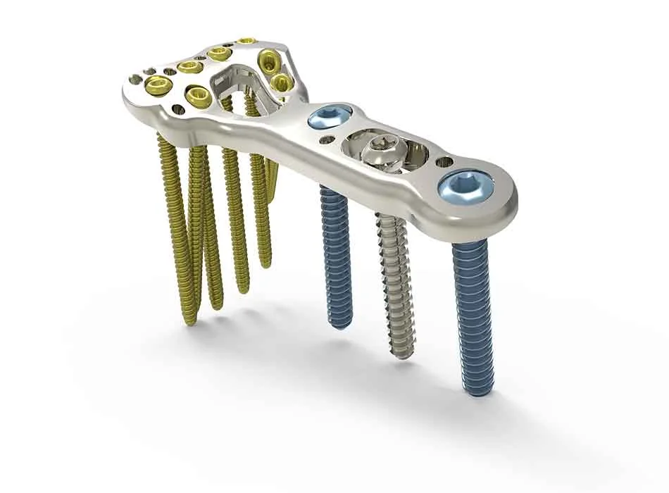 Orthopedic Instruments — Product 0310 — Orthopedic Instruments