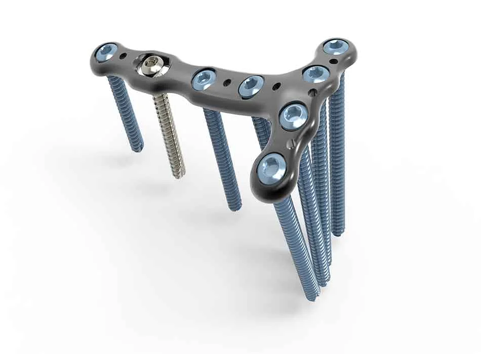 Orthopedic Instruments — Product 0315 — Orthopedic Instruments