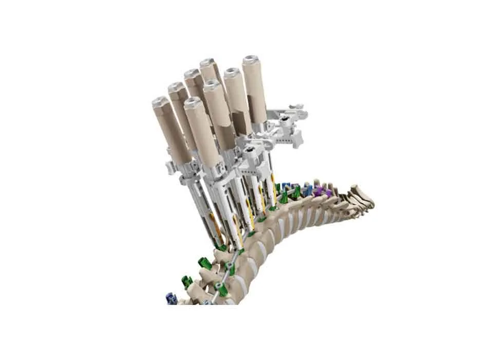 Spinal Instruments — Product 0340 — Spinal Instruments