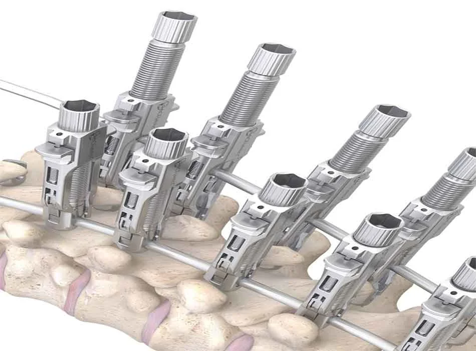 Spinal Instruments — Product 0344 — Spinal Instruments
