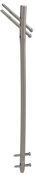 ZFN Multi-Purpose Femoral Nail Systems